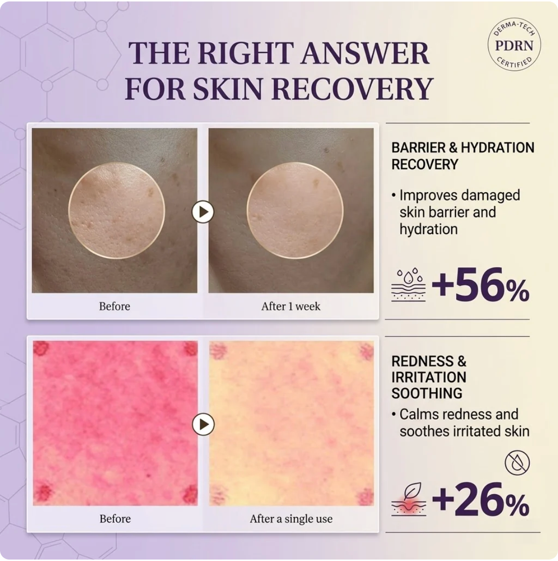 NutriNature™ Expert PDRN Cream