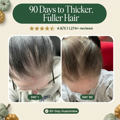 Crown Restoration Ritual — 4-Step PCOS Hair Recovery Bundle